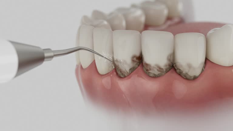 Reliable Dental contractor in Canton, IL by Dentist Open Now
